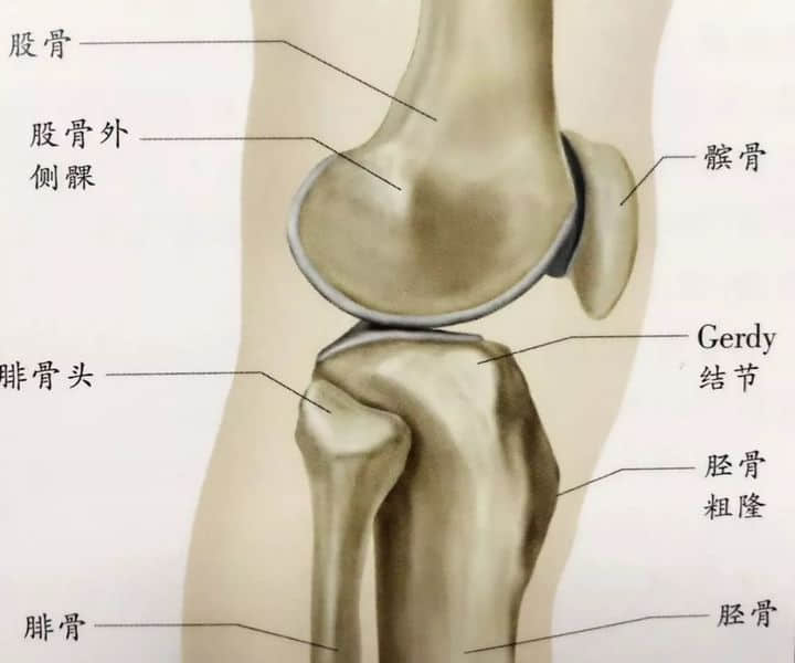 髌骨周围痛，膝“打软”，说说髌股疼痛综合征